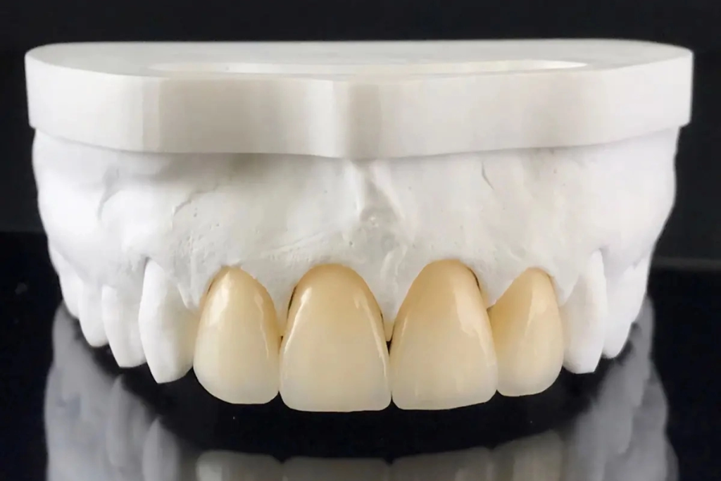 Hire a cosmetic dentistry marketing partner who understands your ideal patient.