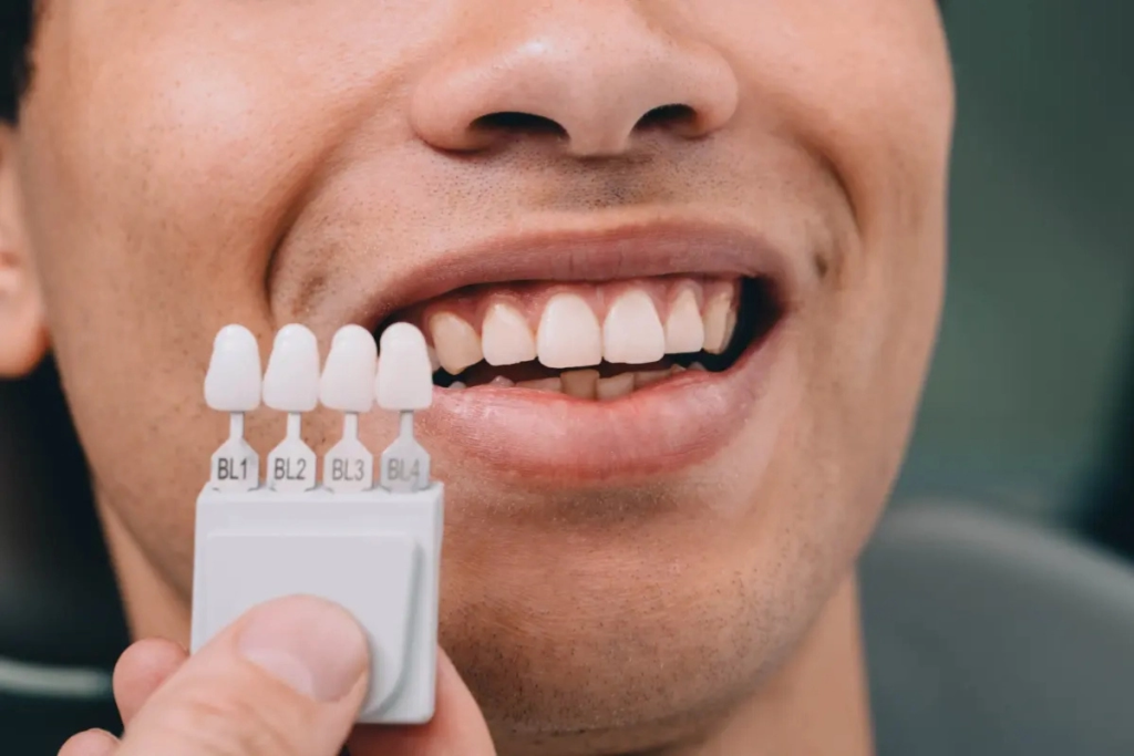 Effective cosmetic dentistry marketing uses proven tactics for predictable results.